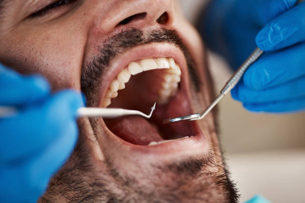 Fast & Reliable Emergency Dental Services in DE